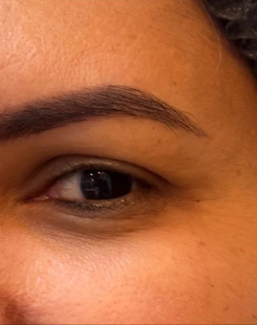 Depois: canto dos olhos com linhas suavizadas