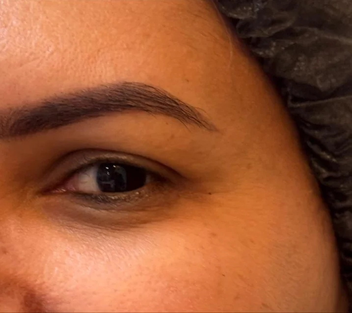 Depois: canto dos olhos com linhas suavizadas